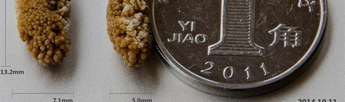 size of a kidney stone